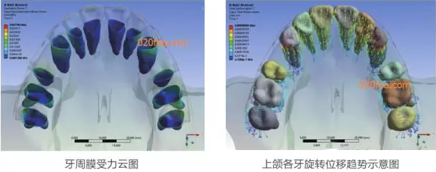 有限元分析法在結(jié)構(gòu)、醫(yī)學(xué)、流體與熱及電場的分析與應(yīng)用