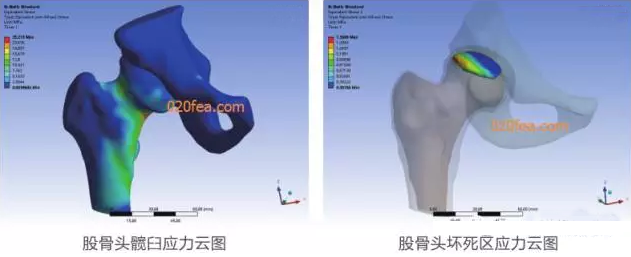 有限元分析法在結(jié)構(gòu)、醫(yī)學(xué)、流體與熱及電場的分析與應(yīng)用